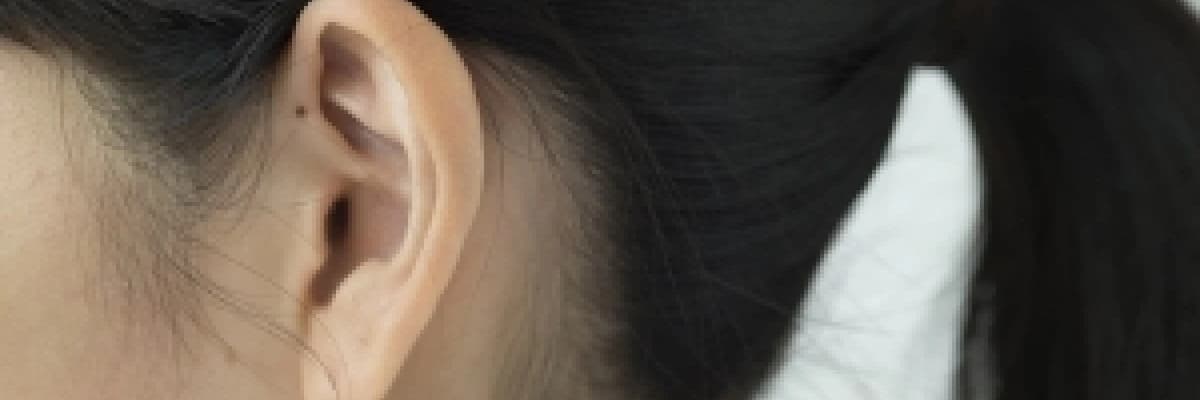 Kepçe Kulak Estetik Ameliyatı