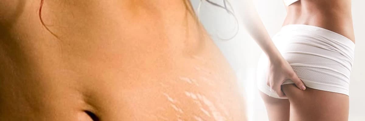 Çatlak & Tedavileri