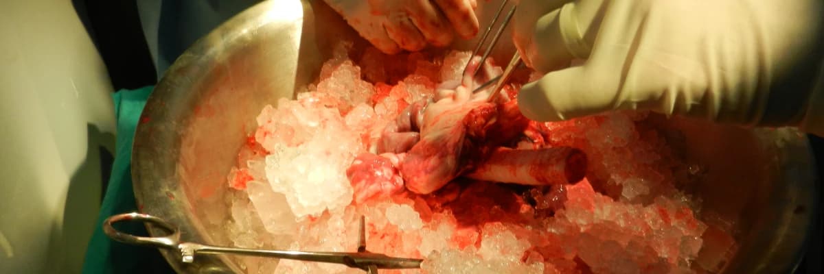 Akciğer Nakli'ne ince bir bakış atalım