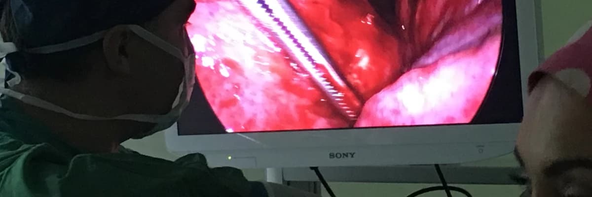 Video Yardımlı Torakoskopik Cerrahi (VATS) Nedir ?