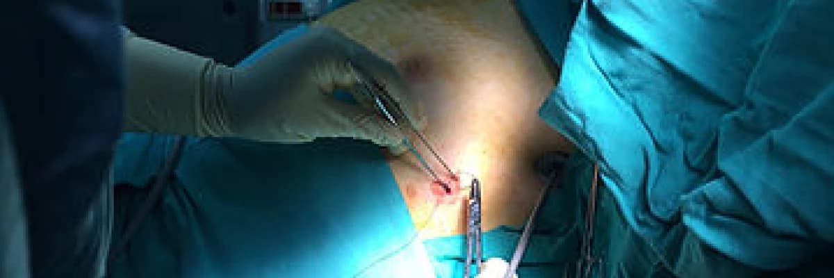 AŞIRI YÜZ TERLEMESİ