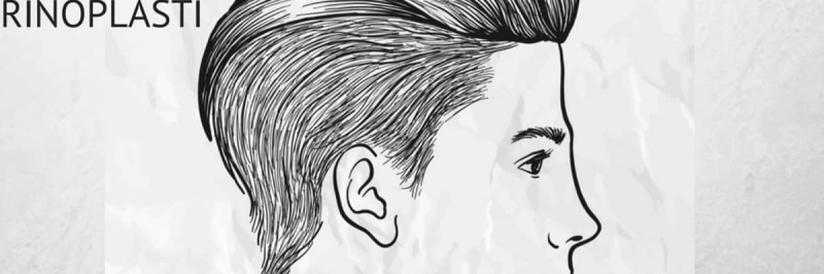 Erkeklerde Rinoplasti