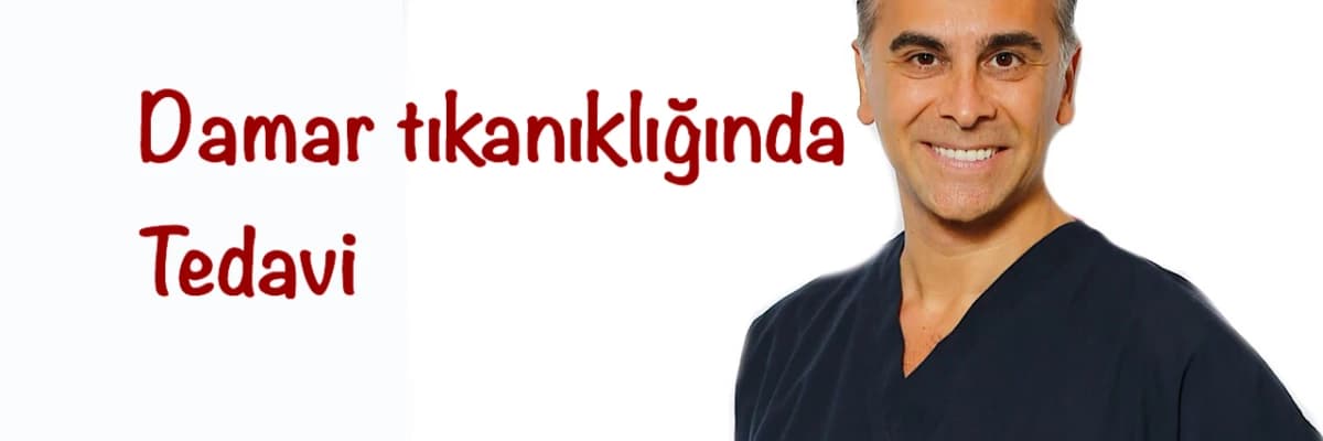 Damar Tıkanıklıkları Her Zaman Açılmalı mıdır?