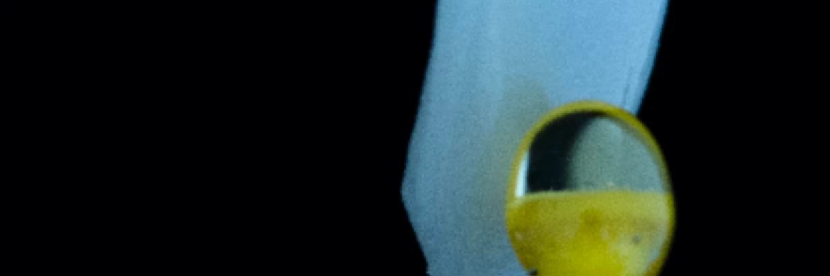 Yaprak Porselen (Porselen Lamina Veneer) nedir? Kimlere uygulanabilir?