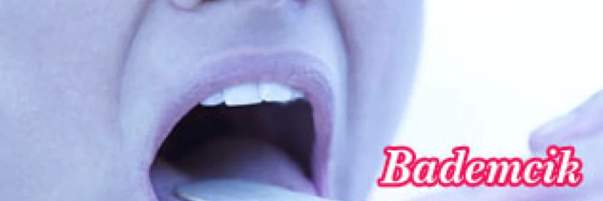 Bademcik büyümeleri