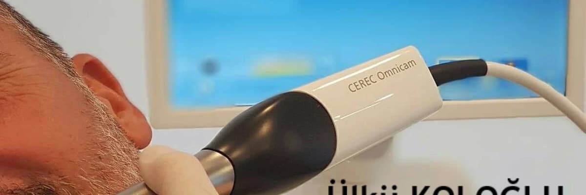 Yeni Nesil Dolgular; CEREC Methodu ile Porselen Dolgu Restorasyonları