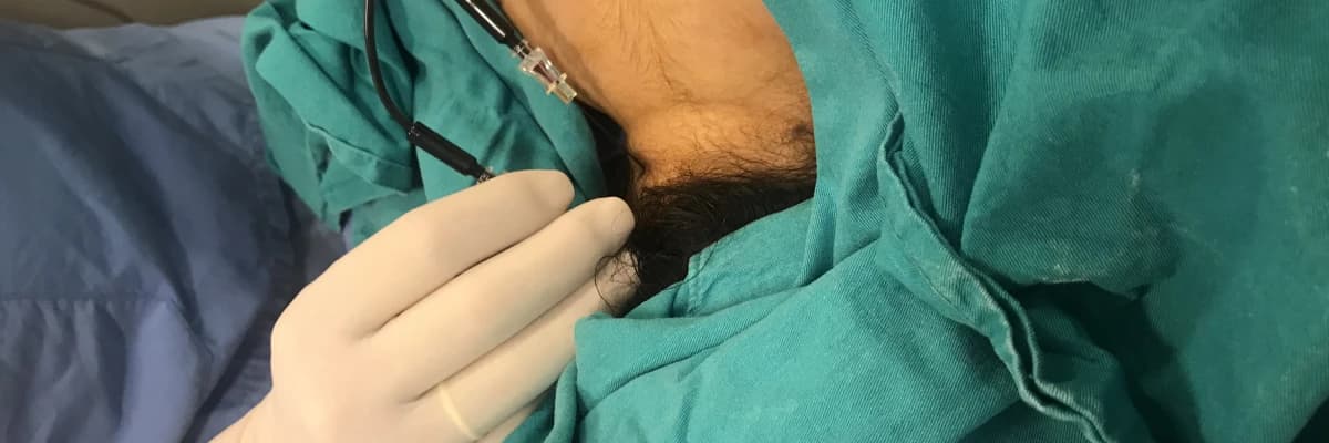 Fibromiyalji Hakkında