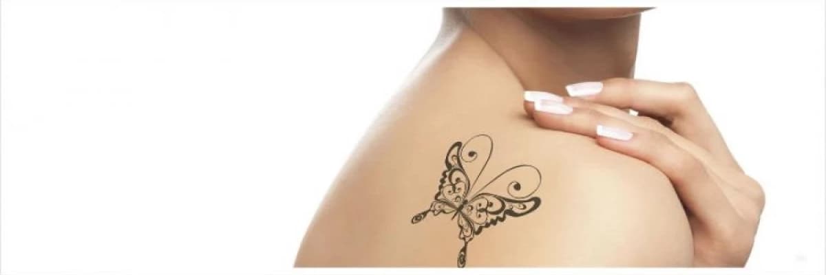 ND:YAG (Q-SWITCHED) LAZER İLE DÖVME SİLİNMESİ