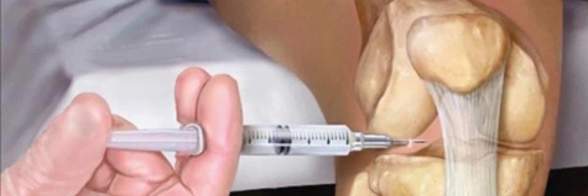 PRP TEDAVİSİ NEDİR (PLATELETTEN ZENGİN PLAZMA)