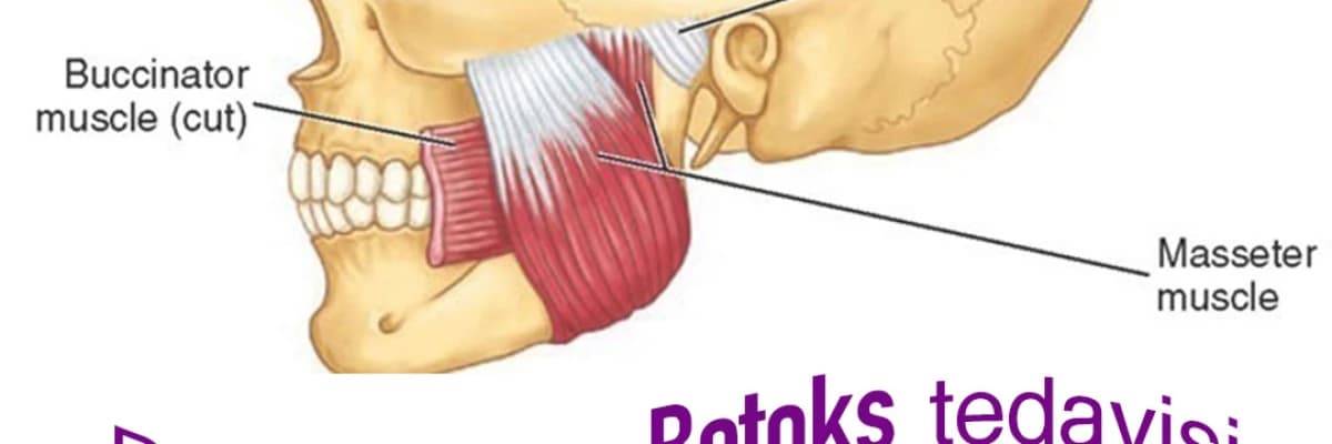Diş Sıkma (Masseter) botoksu nedir?