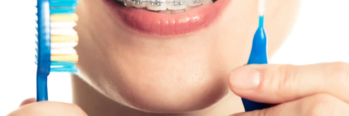Ortodontik Tedavide Ağız Hijyeninin Önemi Ve Ağız Bakımı