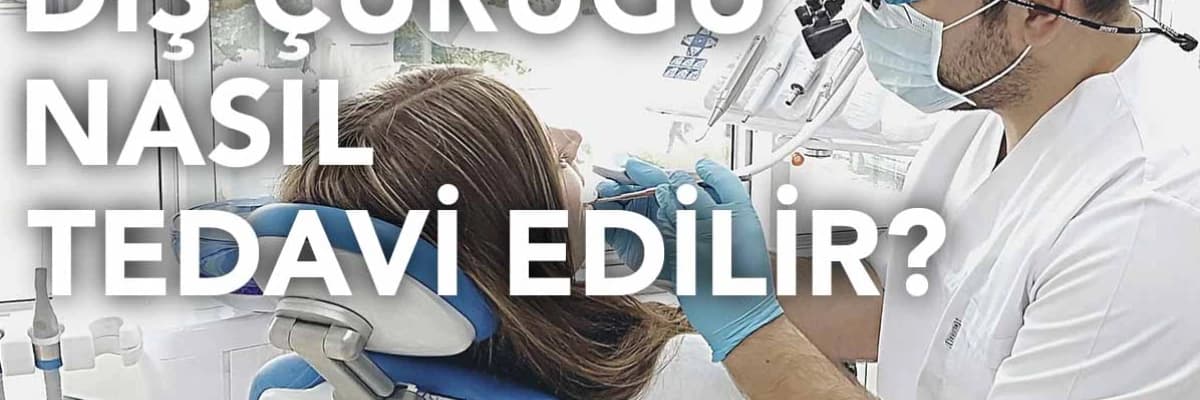 Diş çürüğü nasıl tedavi edilir?