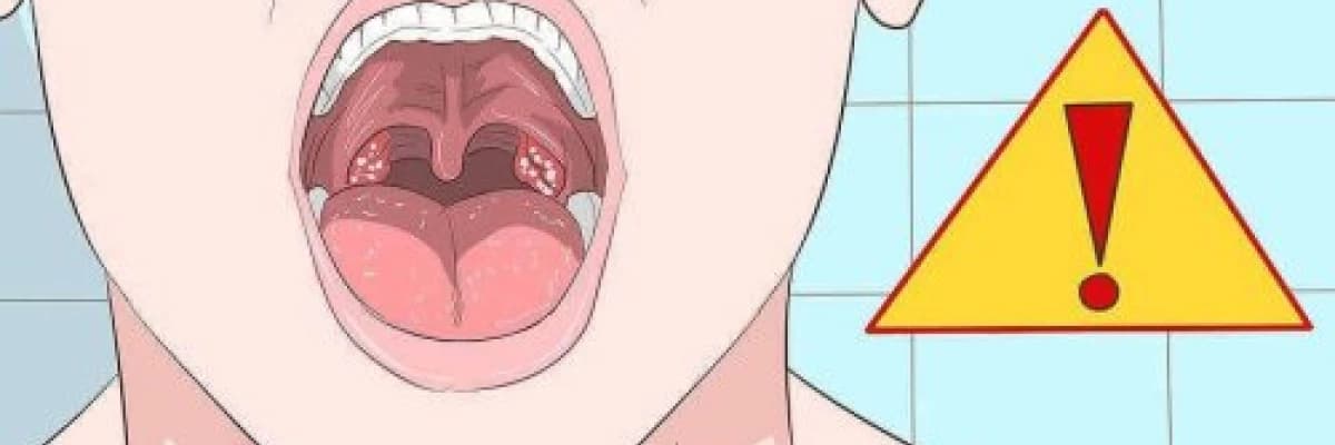 Pediatrik Ses Bozuklukları