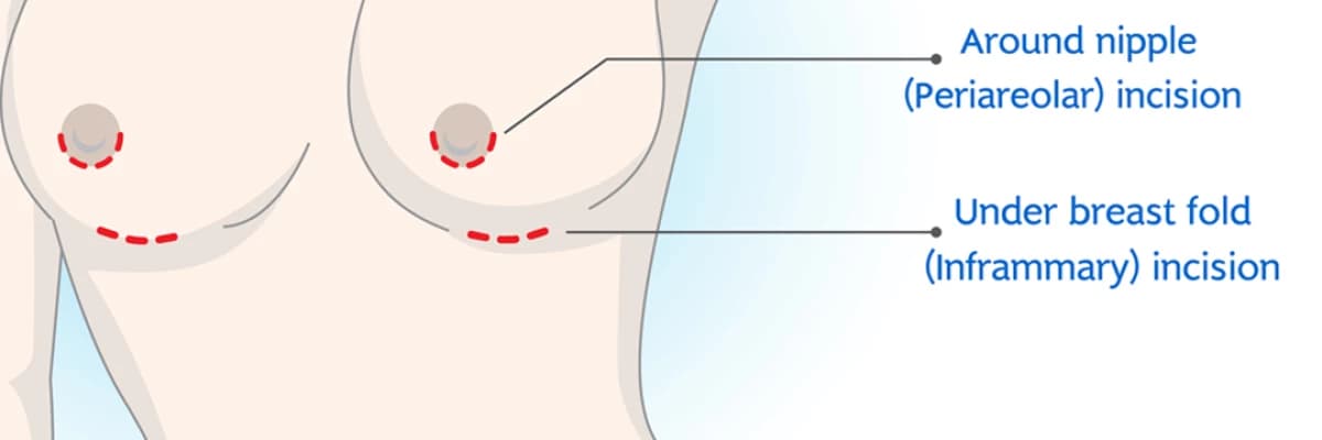 Meme Büyütmede Kesiler