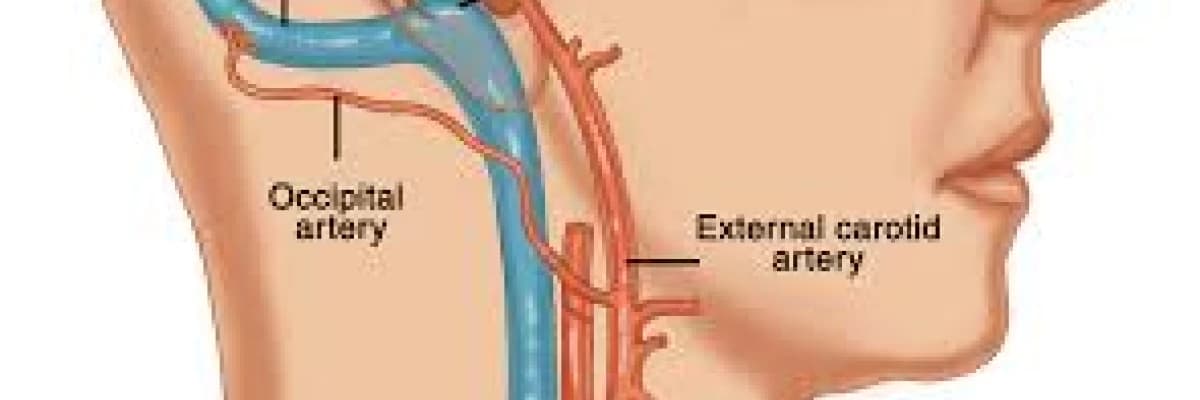 Tinnitus ve damarsal nedenler