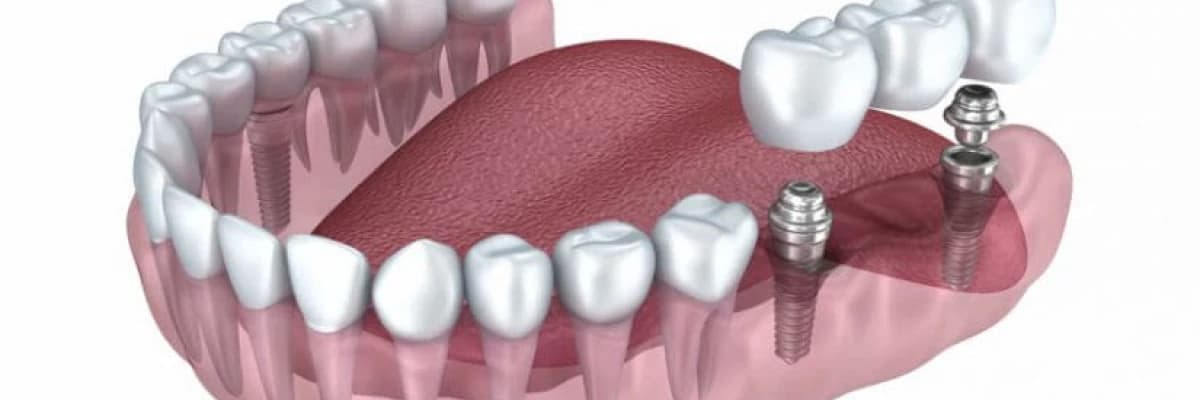 Tüm Yönleriyle Ağız Diş Ve Çene Cerrahisi
