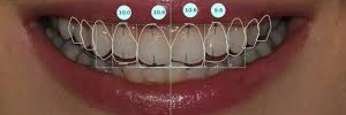 NEDİR BU GÜLÜŞ TASARIMI ?