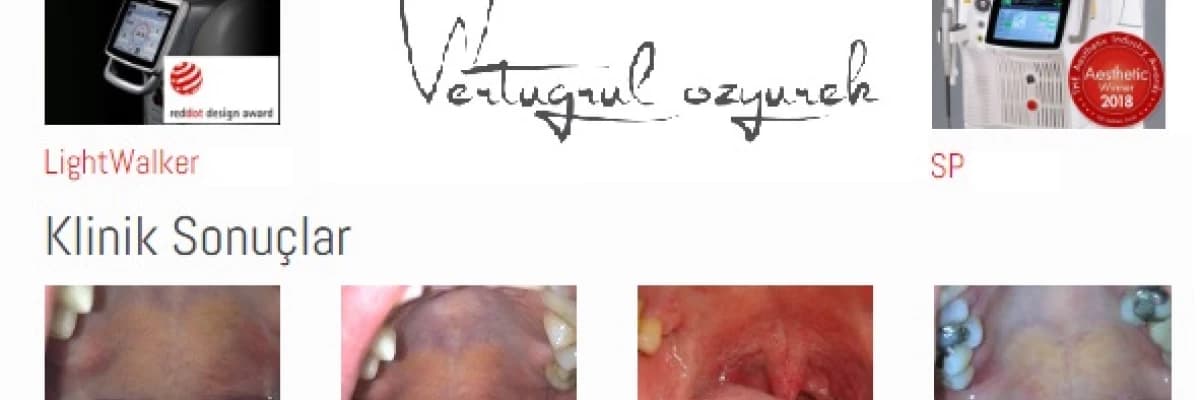 NightLase Lazer Horlama ve Uyku Apnesi Tedavisi