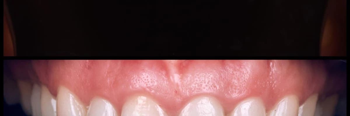 Yaprak Porselen / Lamine