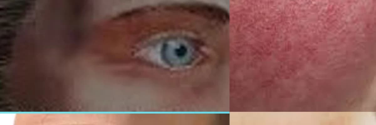 Yüzümüzdeki işaretler, renkler ileride karşılaşabileceğimiz hastalıkların habercisi olabilir mi?