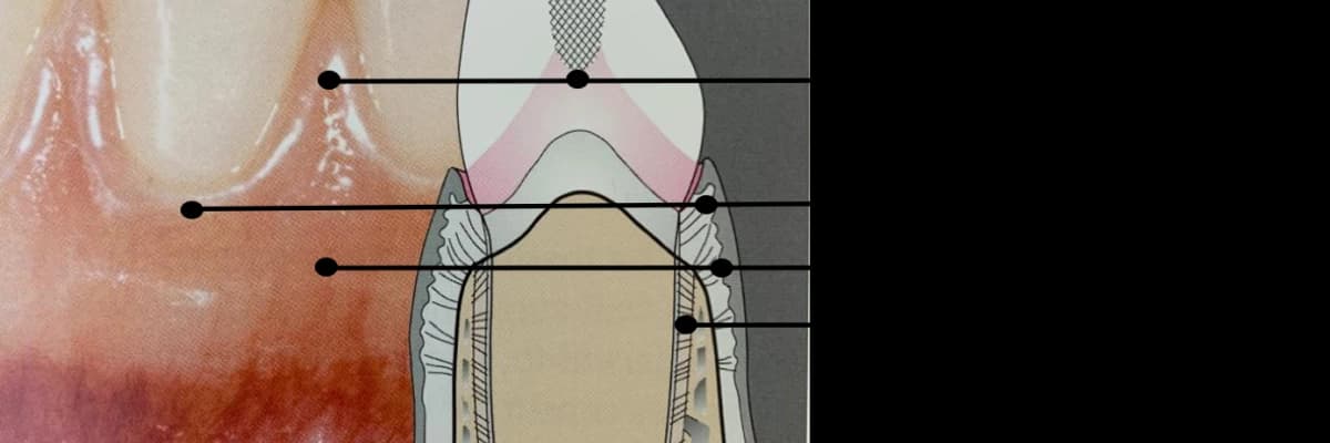 Estetik ve sağlıklı diş eti