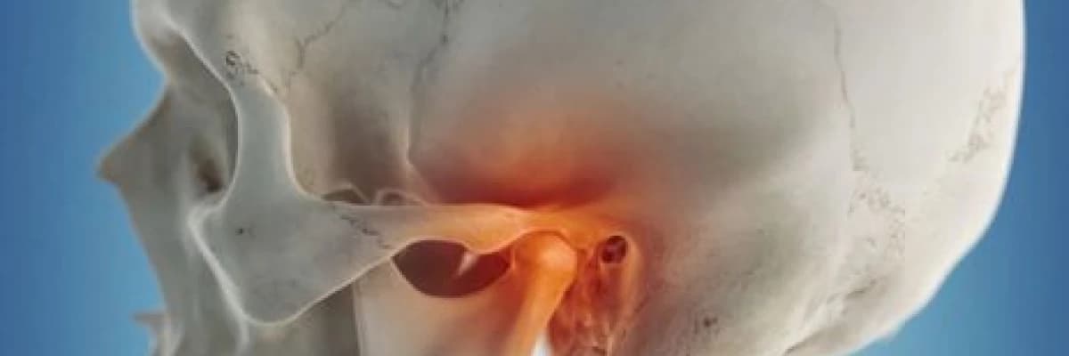 Çene Eklemi Tedavisi