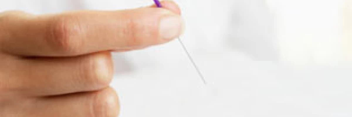 Akupunktur ile migren tedavisi
