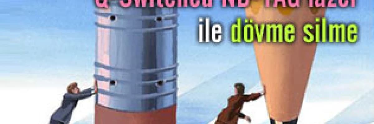 En yeni teknoloji q-switched nd-yag lazer ile dövme silme