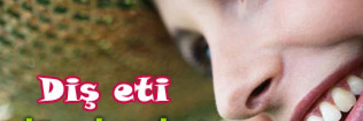 Diş eti düzenlemeleri