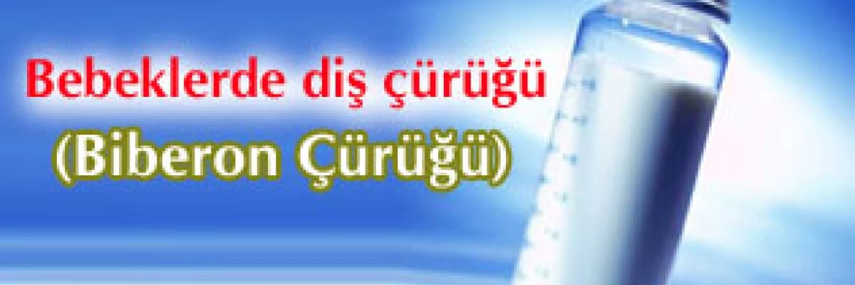 Bebeklerde diş çürüğü (biberon çürüğü)
