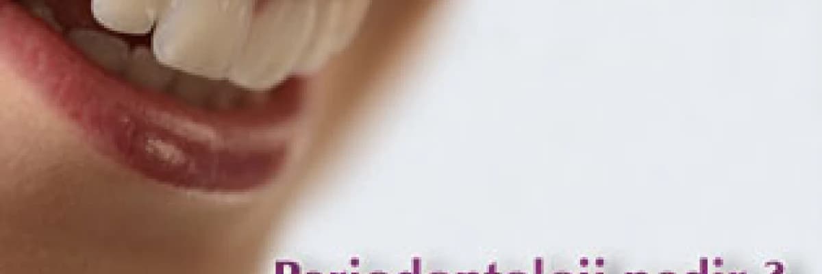 Periodontoloji nedir?
