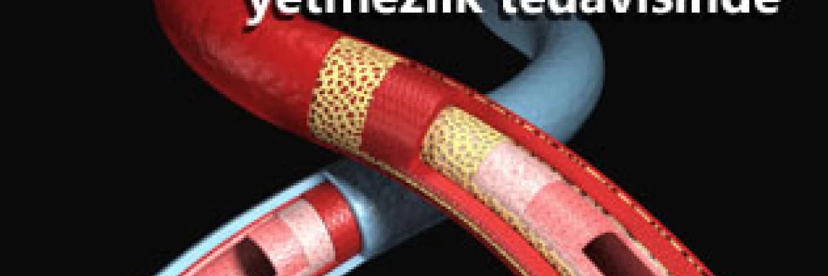 Kılcal damarların tedavisi: skleroterapi