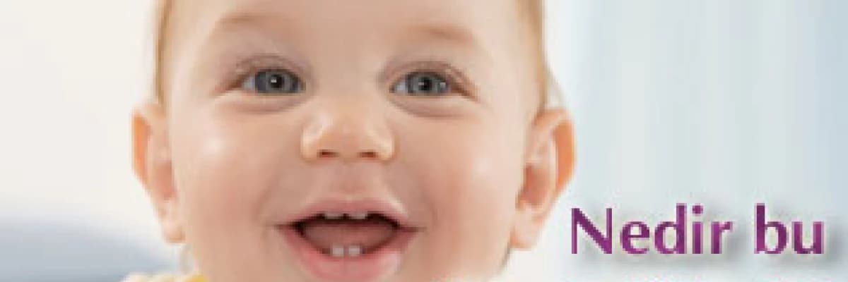 İn midir cin midir ? Nedir bu flor dedikleri ?