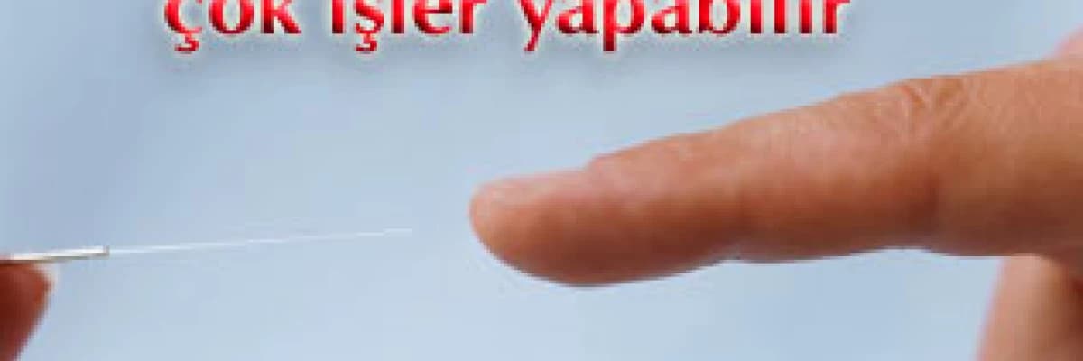 Akupunktur çok işler yapabilir