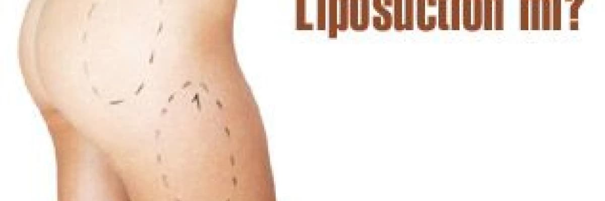 Mezoterapi mi liposuction mı?