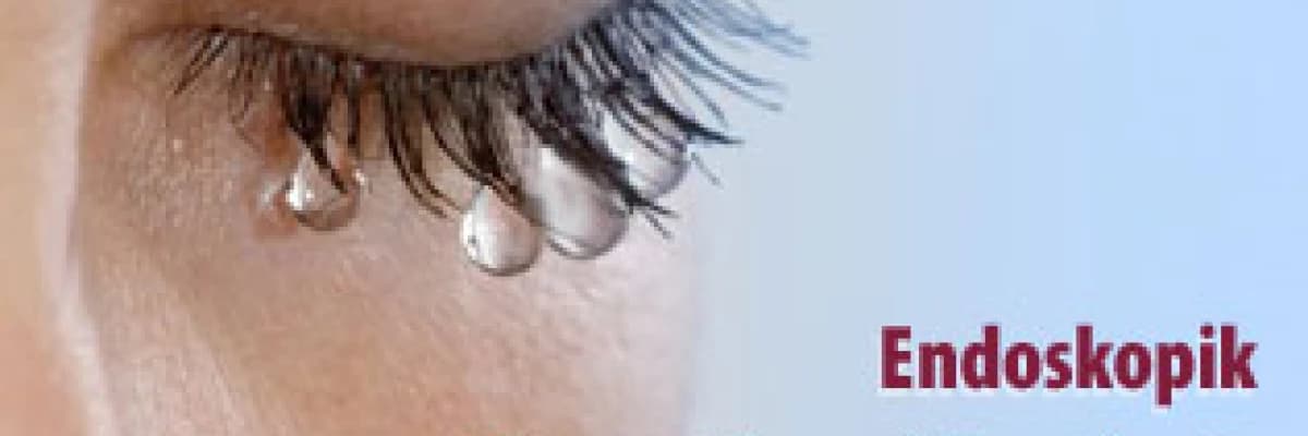 Endoskopik gözyaşı kesesi ameliyatı