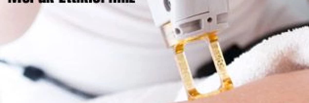 Lazer epilasyon hakkında merak ettikleriniz