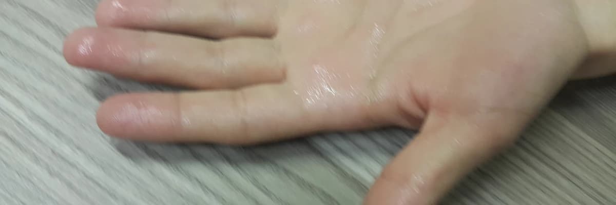 El ve Koltuk altı Aşırı Terleme Tedavisi