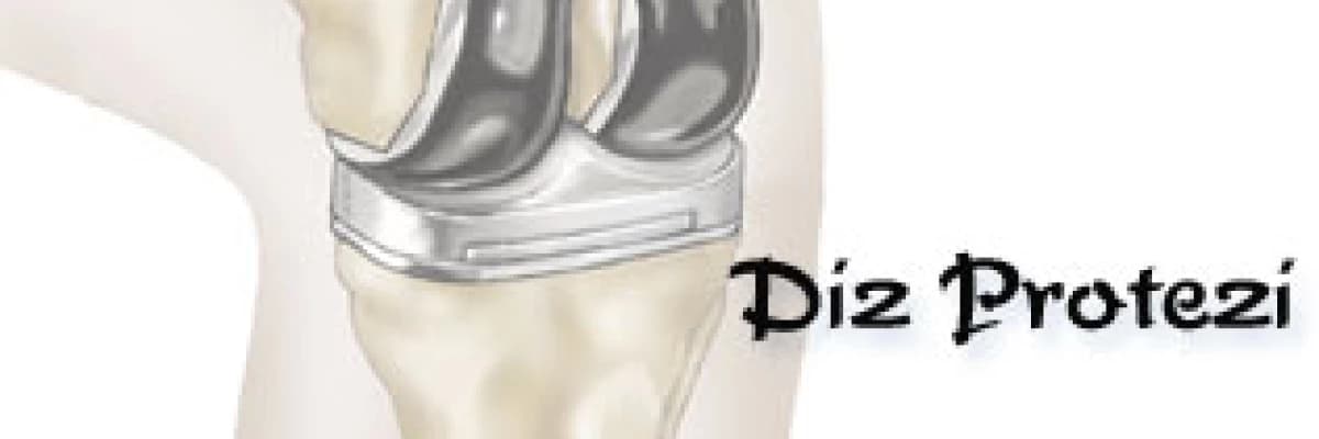 Diz protezi,