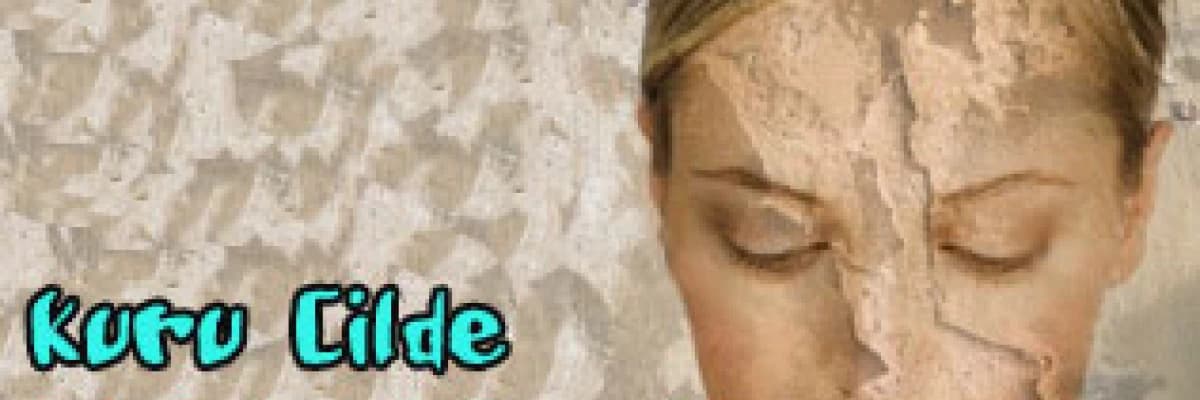 Kuru cilde iyi bakmak gerekir