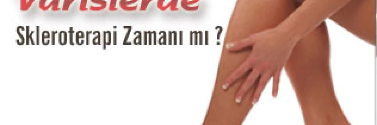 Varislerde skleroterapi zamanı mı ?