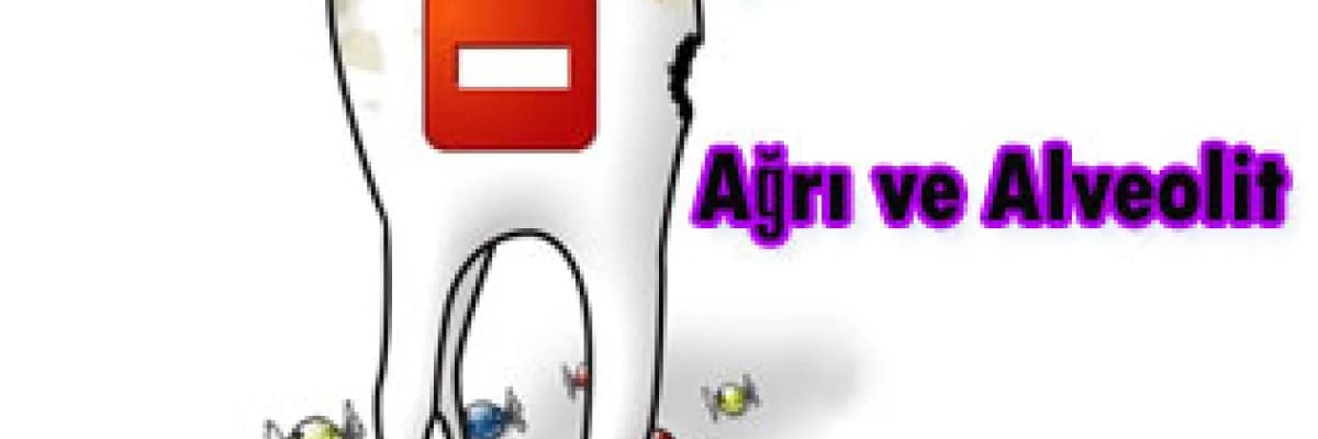 Diş çekimi sonrası ağrı ve alveolit