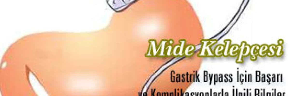 Mide kelepçesi ve gastrik bypass için başarı ve komplikasyonlarla ilgili bilgiler