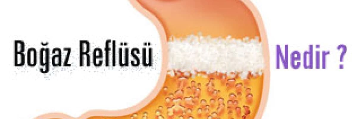 Boğaz reflüsü nedir ?