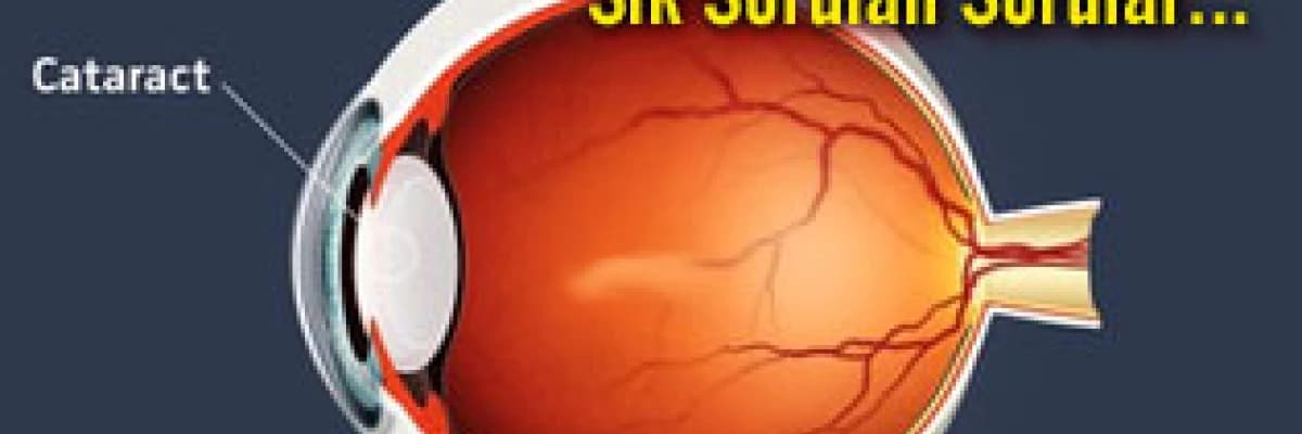Katarakt ameliyatı hakkında sık sorulan sorular...