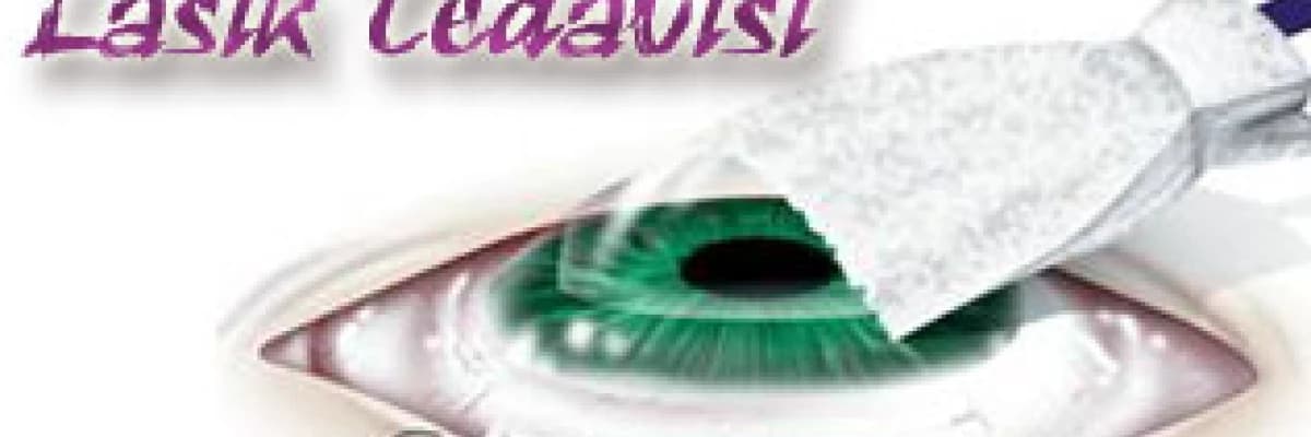 Lasik tedavisi