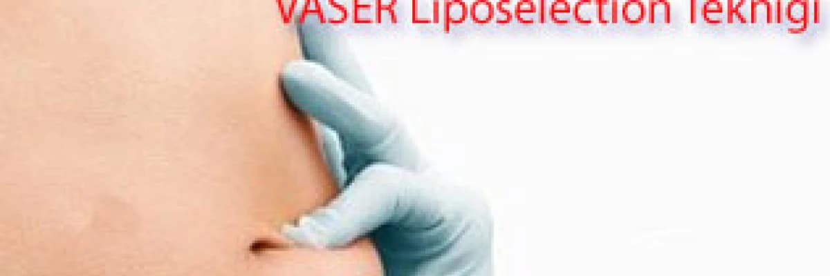 Yağ alma (liposuction) işleminde vaser liposelection tekniği