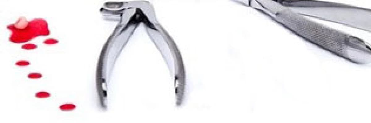 Dişhekimi korkusunu yenmenin pratik yolu: sedasyon !!