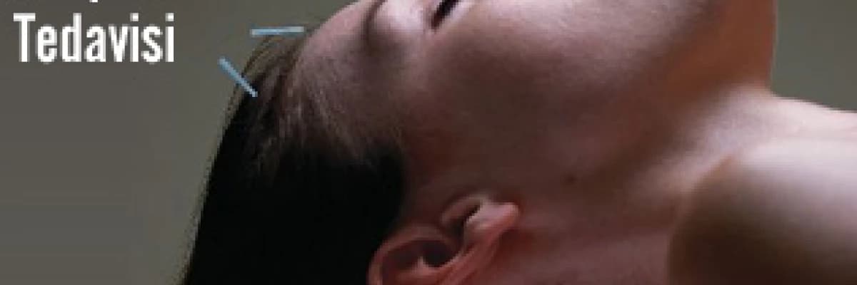 Sinüzit ve akupunktur tedavisi