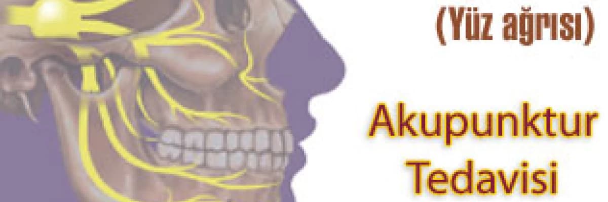 Trigeminal nevraljide (yüz ağrısı) akupunktur tedavisi